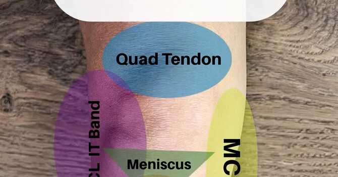 Knee Pain Map: Understanding What Your Pain Location Means image