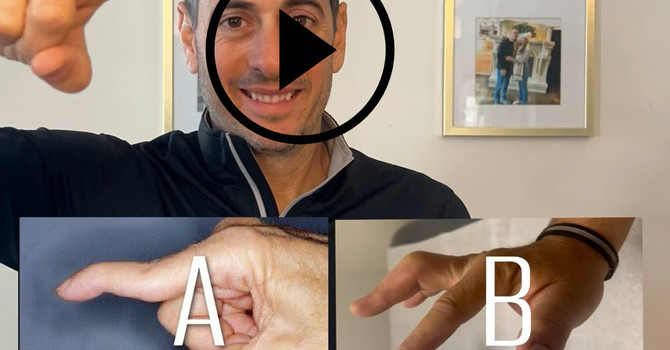 The 5 Most Common Finger Deformities Explained