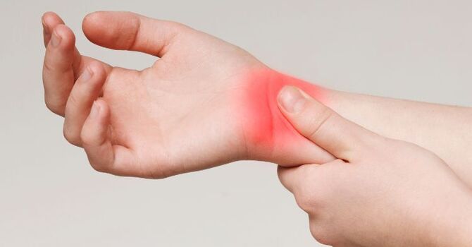 What Is Carpal Tunnel Syndrome? Causes, Symptoms, and How a Chiropractor Can Help